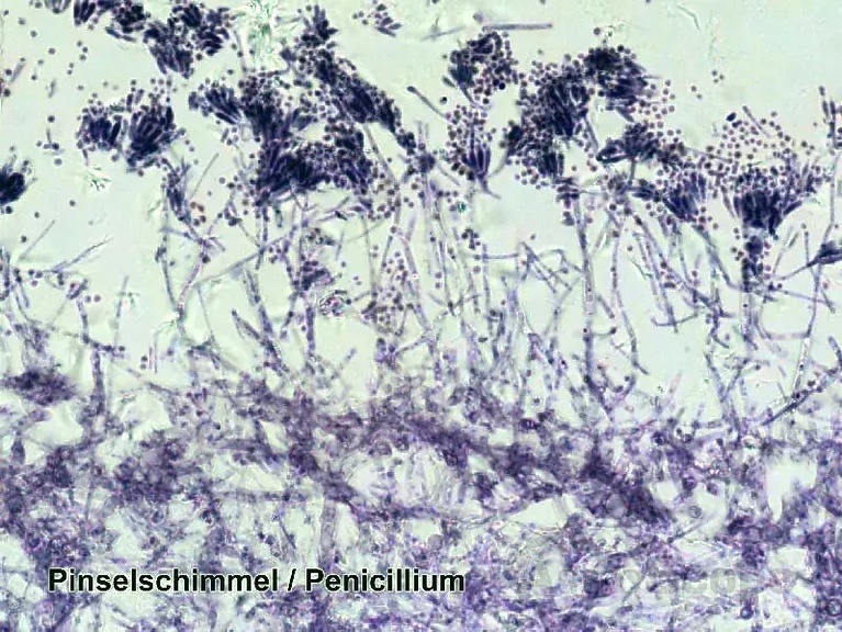 Набор препаратов Bresser 100шт - Фото 3