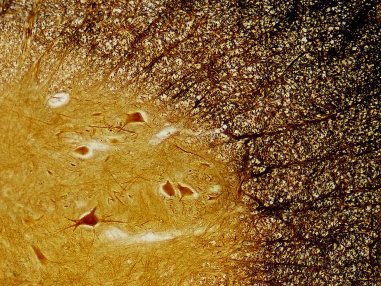 Набор препаратов Bresser 30шт Histology - Фото 4