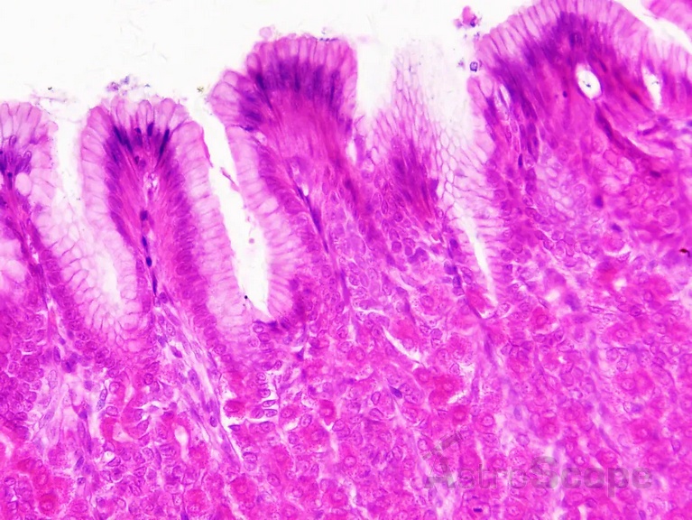 Набор препаратов Bresser 30шт Histology - Фото 5